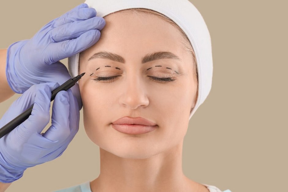 Blefaroplastyka