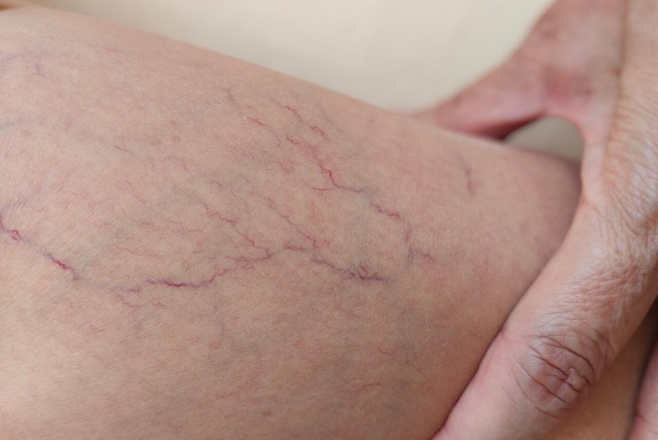 Chirurgia naczyniowa