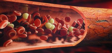  choroby układu krwionośnego